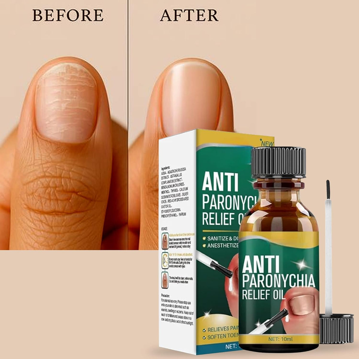 Anti Paronychia Relief Oil ( Buy 1 Get 1 Free)