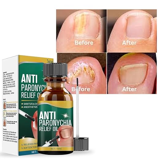 Anti Paronychia Relief Oil ( Buy 1 Get 1 Free)