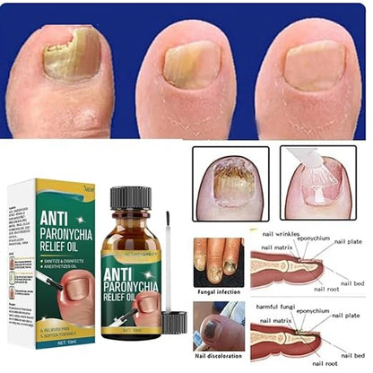Anti Paronychia Relief Oil ( Buy 1 Get 1 Free)