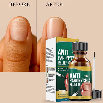 Anti Paronychia Relief Oil ( Buy 1 Get 1 Free)